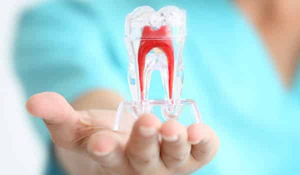 Striving to Make Root Canal Treatment Painless