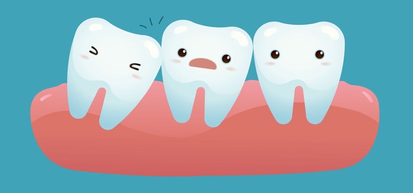 What to do in a Dental Emergency