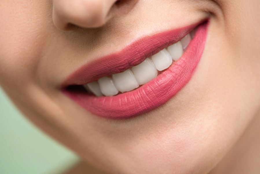 How To Get A Beautiful White Smile?